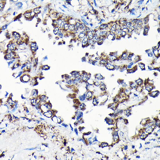 Anti-USP5 Antibody (CAB4202)