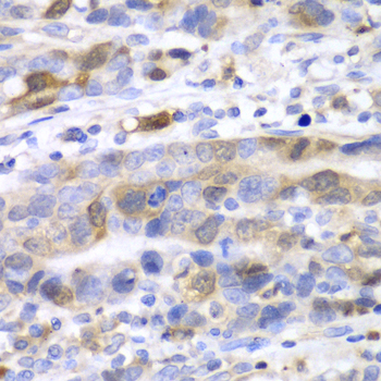 Anti-UBE2C Antibody (CAB5499)