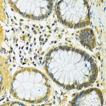 Anti-SLC25A1 Antibody (CAB10247)