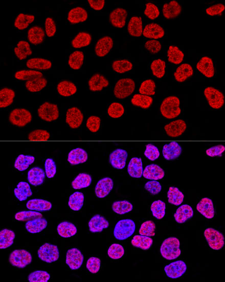 Anti-Histone H2AX Antibody (CAB11361)