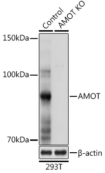 Anti-Angiomotin Polyclonal Antibody (CAB8075)