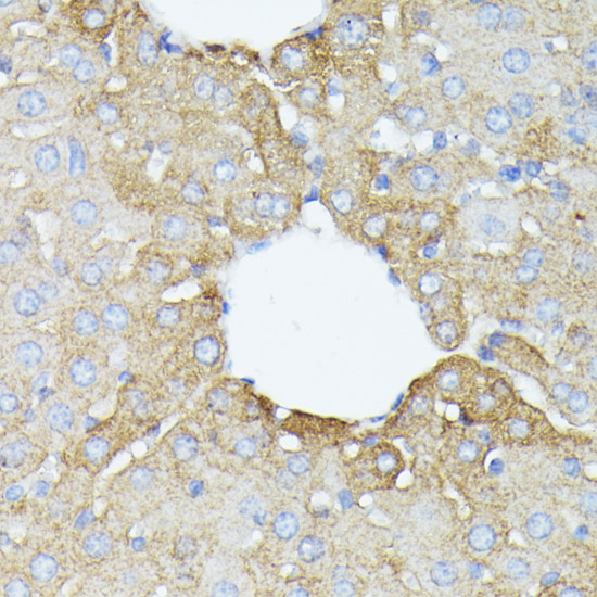 Anti-PFDN4 Antibody (CAB15300)