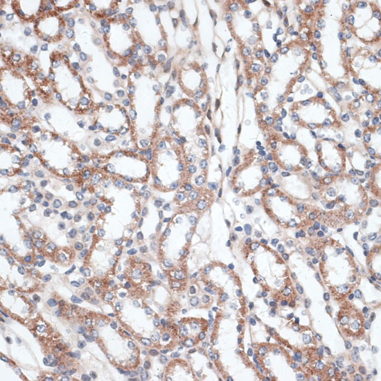 Anti-PLAA Antibody (CAB16466)