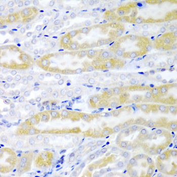 Anti-FABP6 Antibody (CAB6906)