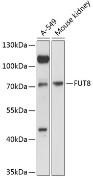 Anti-FUT8 Antibody (CAB12933)