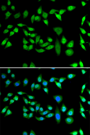 Anti-DNAJB6 Antibody (CAB7052)