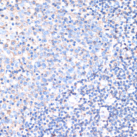 Anti-CD44 Antibody (CAB1351)