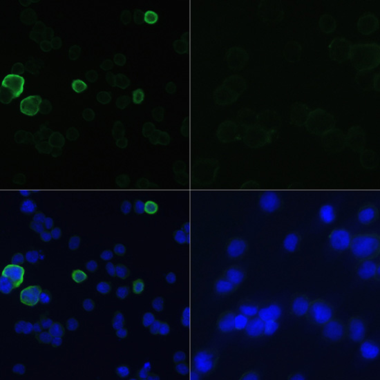 Anti-Mouse anti Myc-Tag Monoclonal Antibody (CABE010)
