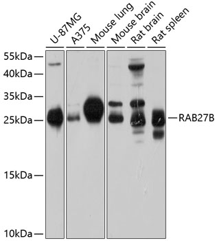 Anti-RAB27B Antibody (CAB10389)