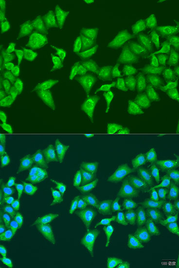 Anti-HYLS1 Polyclonal Antibody (CAB8285)