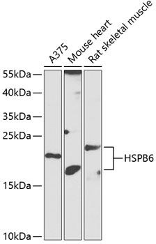 Anti-HSPB6 Antibody (CAB14158)