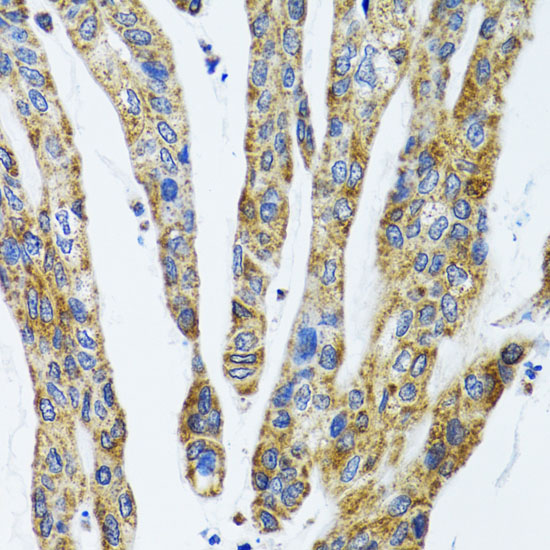 Anti-GAB1 Antibody (CAB6248)