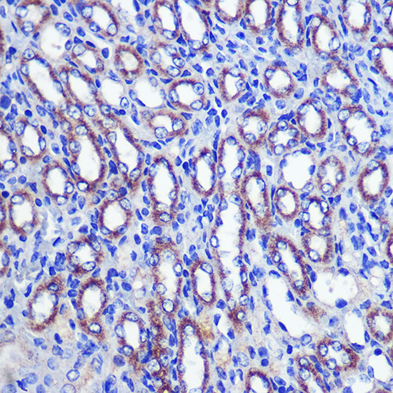 Anti-LETMD1 Antibody (CAB2147)