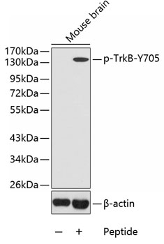 Anti-Phospho-NTRK2-Y705 Antibody (CABP0423)