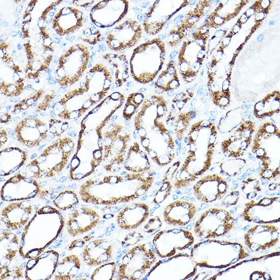 Anti-HK1 Antibody [KO Validated] (CAB1054)