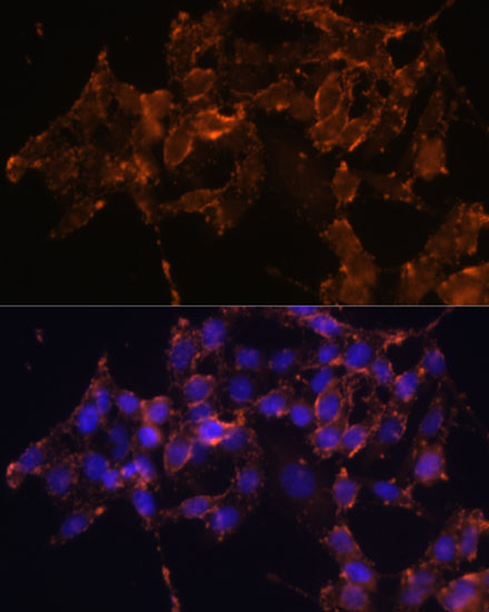 Anti-PTGS1 Antibody (CAB7341)