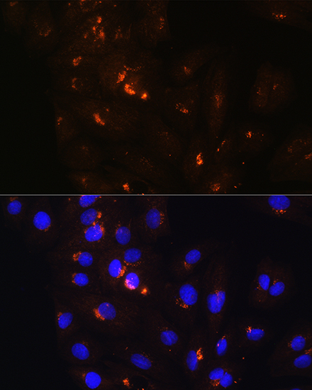 Anti-POFUT2 Antibody (CAB12223)