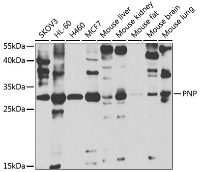 Anti-PNP Antibody (CAB5778)