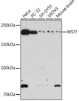 Anti-WSTF Antibody (CAB9519)