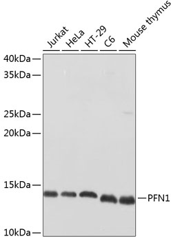 Anti-PFN1 Antibody (CAB1164)