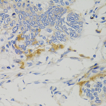 Anti-PTPN11 Antibody (CAB2793)