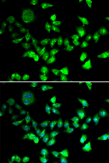 Anti-SMC1A Antibody (CAB2240)