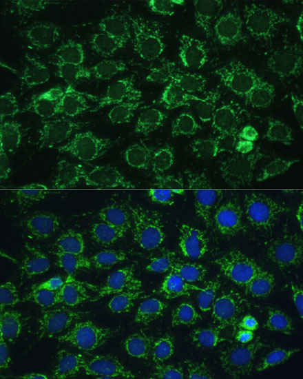 Anti-ATP5C1 Antibody (CAB15257)