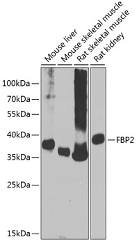 Anti-FBP2 Polyclonal Antibody (CAB9850)