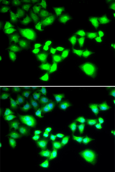 Anti-RAD1 Antibody (CAB6841)