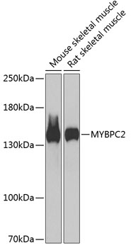 Anti-MYBPC2 Antibody (CAB13331)