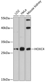 Anti-HOXC4 Polyclonal Antibody (CAB8986)