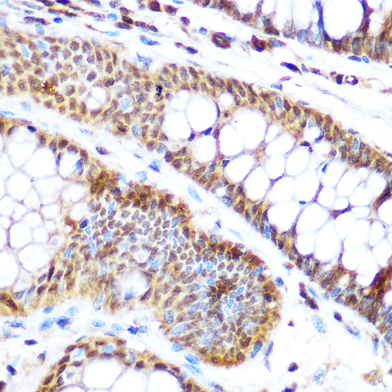 Anti-SP3 Antibody (CAB12790)