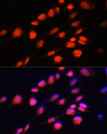 Anti-ZNF416 Antibody (CAB14910)