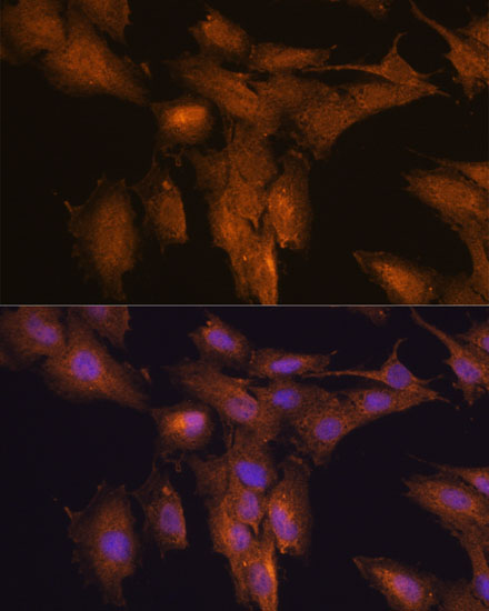 Anti-TSLP Antibody (CAB13134)