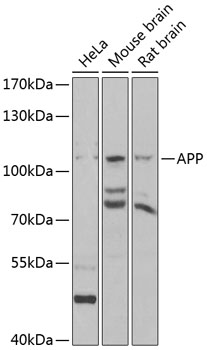 Anti-APP Antibody (CAB11019)