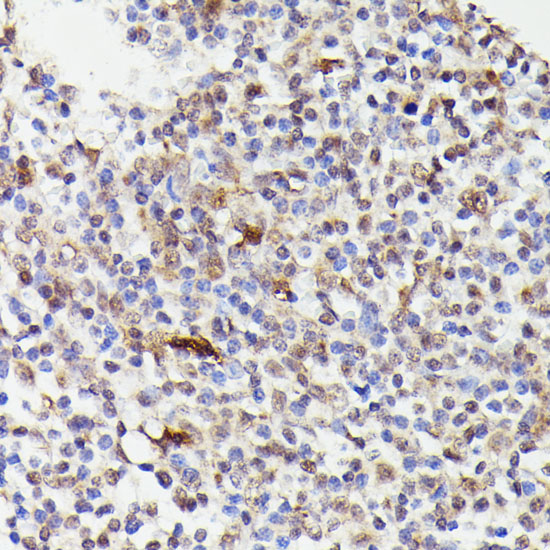 Anti-CDC23 Antibody (CAB15116)