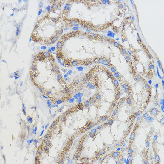 Anti-CYP51A1 Antibody (CAB13485)