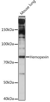 Anti-Hemopexin Antibody (CAB9133)