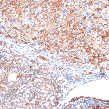 Anti-SLAMF7 Antibody (CAB16565)