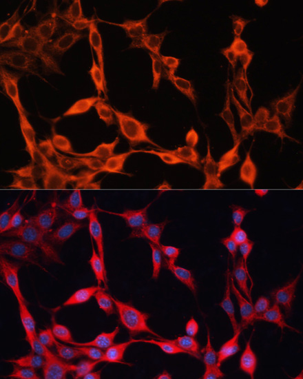 Anti-SLC25A23 Antibody (CAB14352)