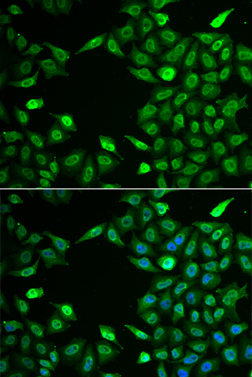 Anti-INTS6 Antibody (CAB6634)