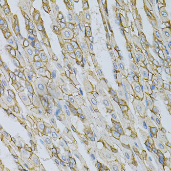 Anti-AP2B1 Antibody (CAB1995)