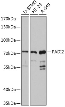 Anti-PADI2 Antibody (CAB12236)