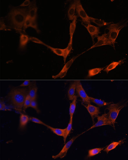 Anti-HMGCR Antibody (CAB16875)