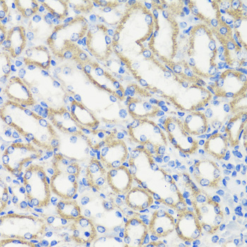 Anti-DEPDC6 Antibody (CAB17305)