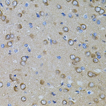 Anti-Gm13125 Antibody (CAB12619)