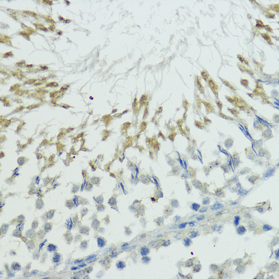 Anti-TRIP12 Polyclonal Antibody (CAB9958)