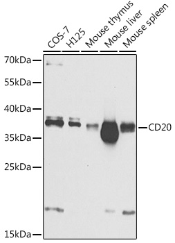 Anti-CD20 Antibody (CAB1793)