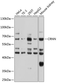 Anti-Cornulin Polyclonal Antibody (CAB8762)