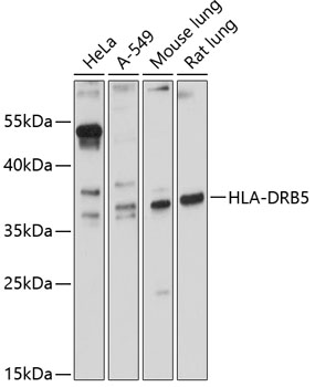 Anti-HLA-DRB5 Antibody (CAB12726)